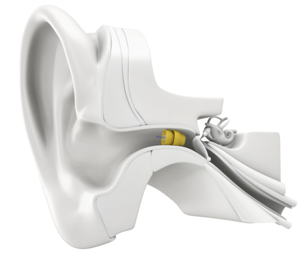 lyric-in-ear-600x508-1-1